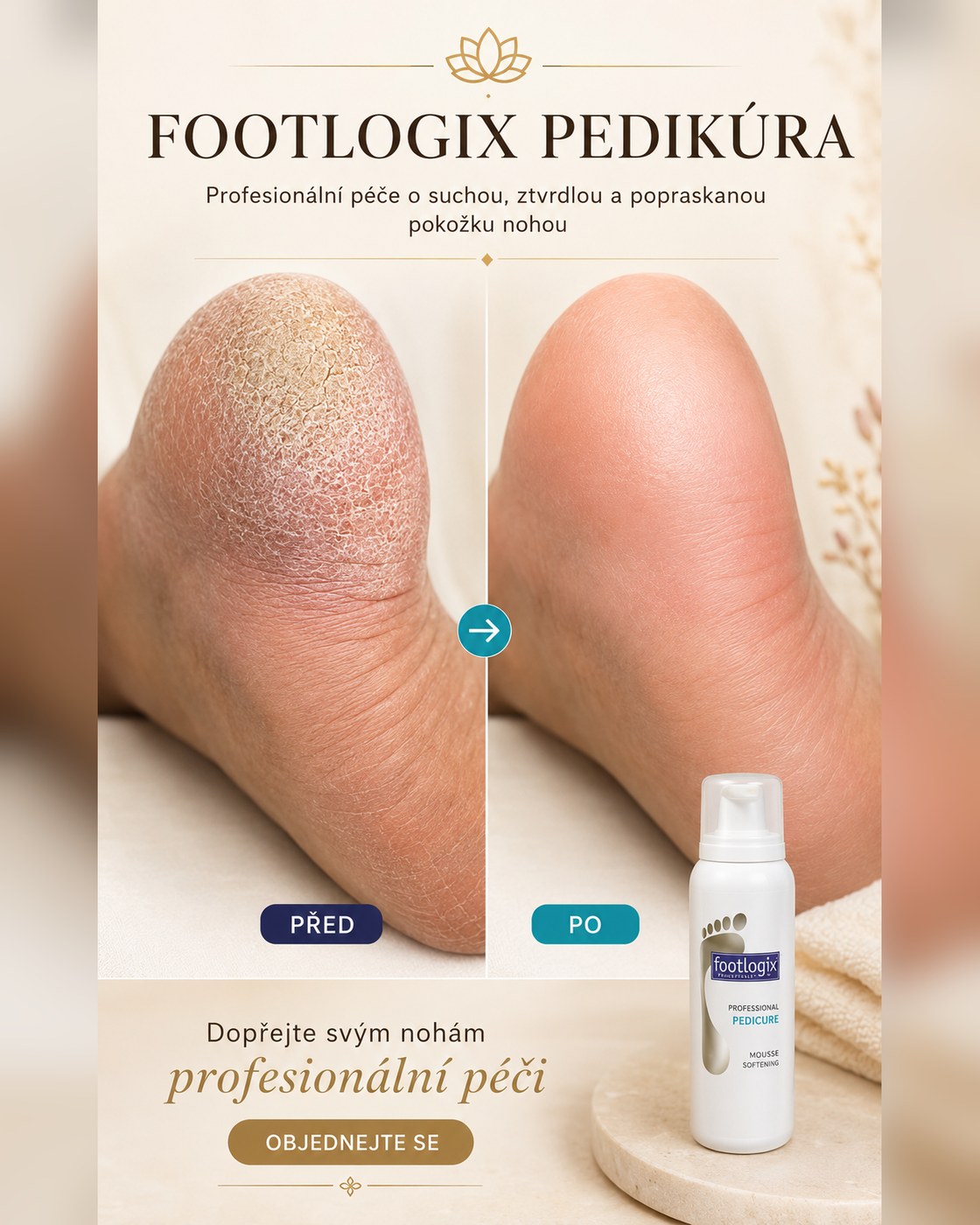 Footlogix Pedikúra